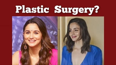 Alia Bhatt Plastic Surgery